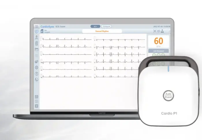 Eletrocardiógrafo Digital 12 Canais Bionet para PC com Software CardioCare P1