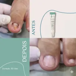 Fortalecedor De Unhas Pro Unha 30g Fragrância Suave