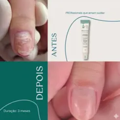 Fortalecedor De Unhas Pro Unha 30g Fragrância Suave