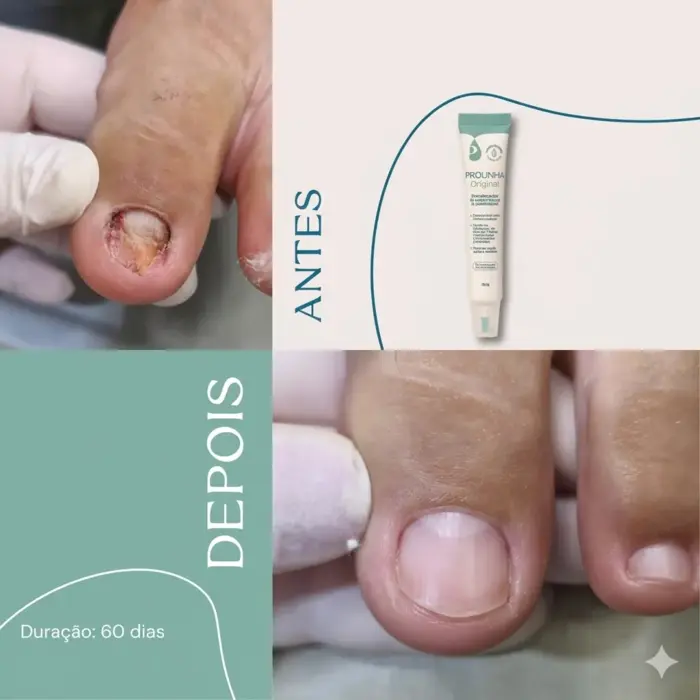Fortalecedor De Unhas Pro Unha 30g Fragrância Suave