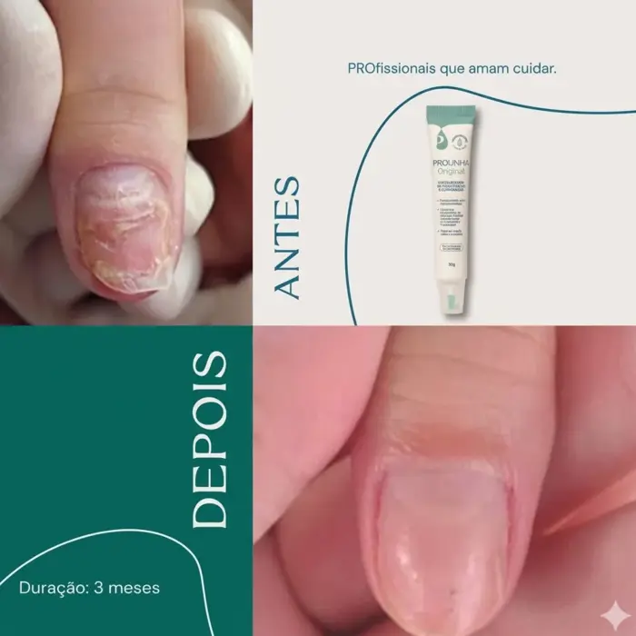 Fortalecedor De Unhas Pro Unha 30g Fragrância Suave